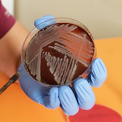 Micro-biología Holanda